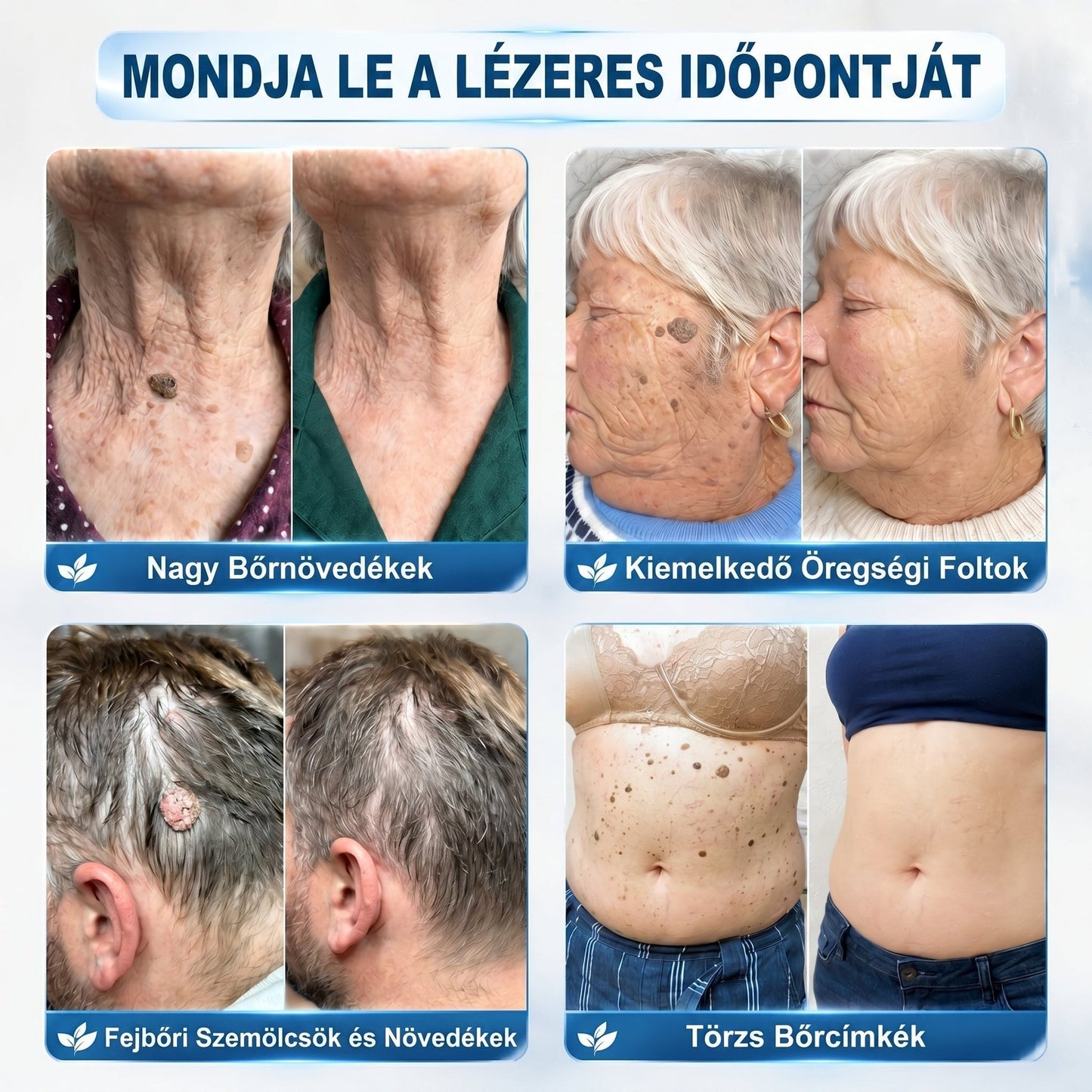 ✅🪵𝐇𝐢𝐯𝐚𝐭𝐚𝐥𝐨𝐬 𝐦á𝐫𝐤𝐚𝐛𝐨𝐥𝐭  𝐇𝐞𝐚𝐥𝐫𝐢𝐳𝐞®   𝟕 𝐍𝐚𝐩𝐨𝐬 𝐁ő𝐫𝐤𝐢𝐧ö𝐯é𝐬- é𝐬 𝐅𝐨𝐥𝐭𝐫𝐚𝐝í𝐫(Fájdalommentes, nyommentes roll-on)
