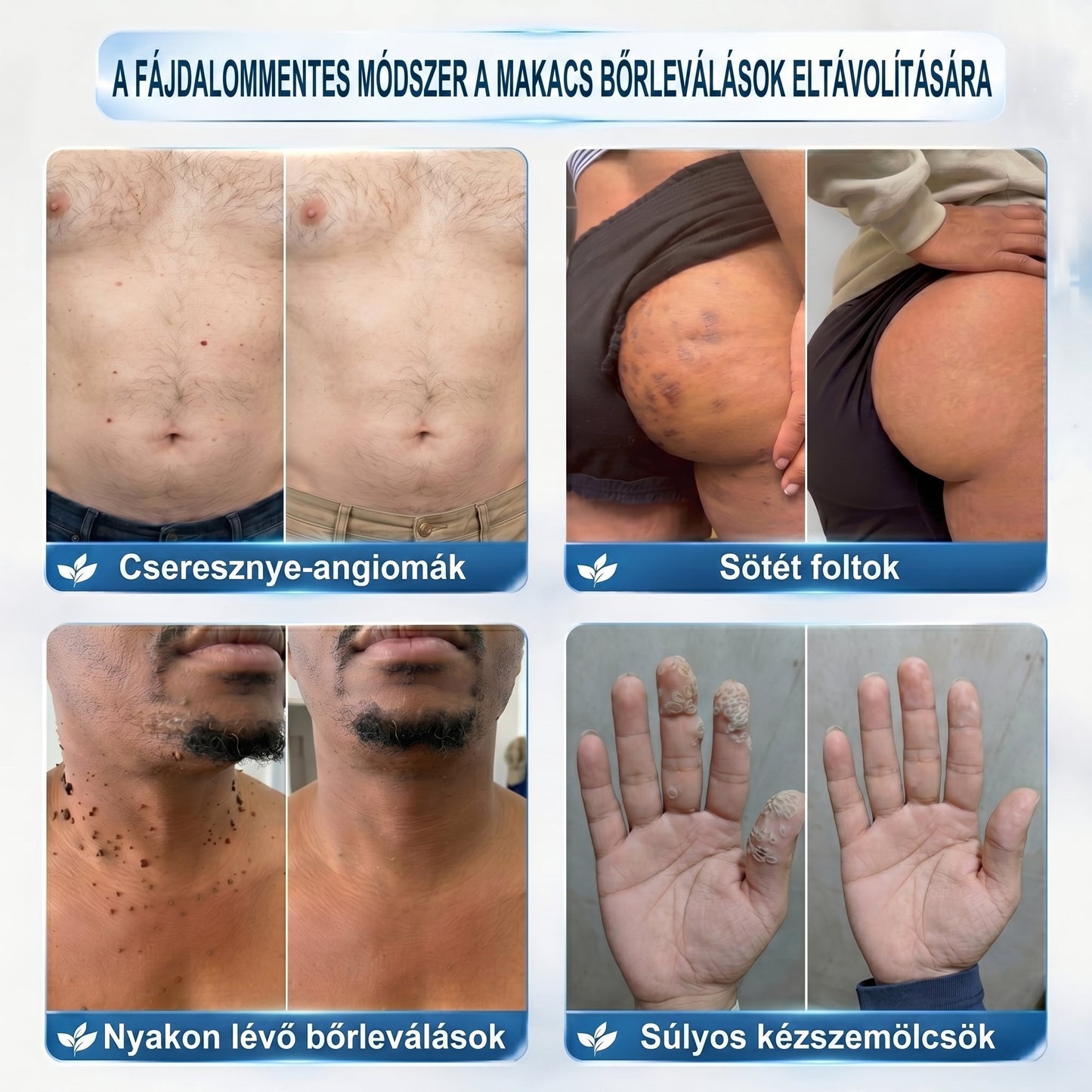 ✅🪵𝐇𝐢𝐯𝐚𝐭𝐚𝐥𝐨𝐬 𝐦á𝐫𝐤𝐚𝐛𝐨𝐥𝐭  𝐇𝐞𝐚𝐥𝐫𝐢𝐳𝐞®   𝟕 𝐍𝐚𝐩𝐨𝐬 𝐁ő𝐫𝐤𝐢𝐧ö𝐯é𝐬- é𝐬 𝐅𝐨𝐥𝐭𝐫𝐚𝐝í𝐫(Fájdalommentes, nyommentes roll-on)