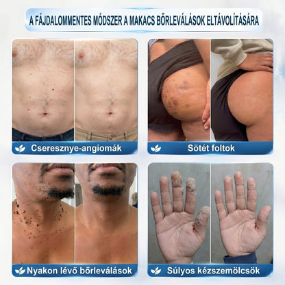 ✅🪵𝐇𝐢𝐯𝐚𝐭𝐚𝐥𝐨𝐬 𝐦á𝐫𝐤𝐚𝐛𝐨𝐥𝐭  𝐇𝐞𝐚𝐥𝐫𝐢𝐳𝐞®   𝟕 𝐍𝐚𝐩𝐨𝐬 𝐁ő𝐫𝐤𝐢𝐧ö𝐯é𝐬- é𝐬 𝐅𝐨𝐥𝐭𝐫𝐚𝐝í𝐫(Fájdalommentes, nyommentes roll-on)