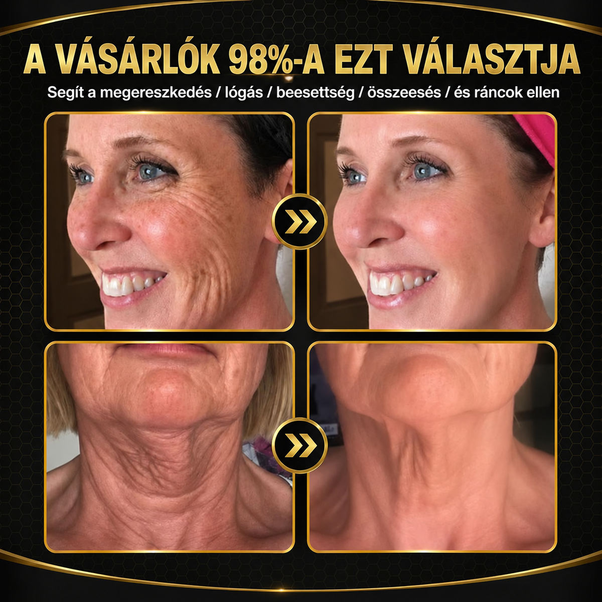 Rolimey® Méhmérges Bőrápoló Krém👩‍⚕️2🌲