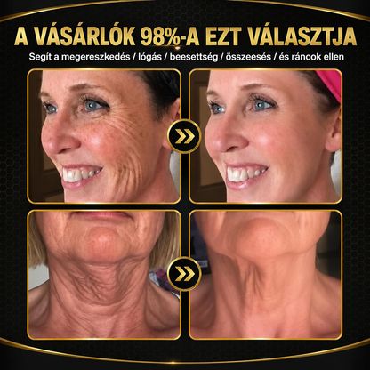 Rolimey® Méhmérges Bőrápoló Krém👩‍⚕️2🌲