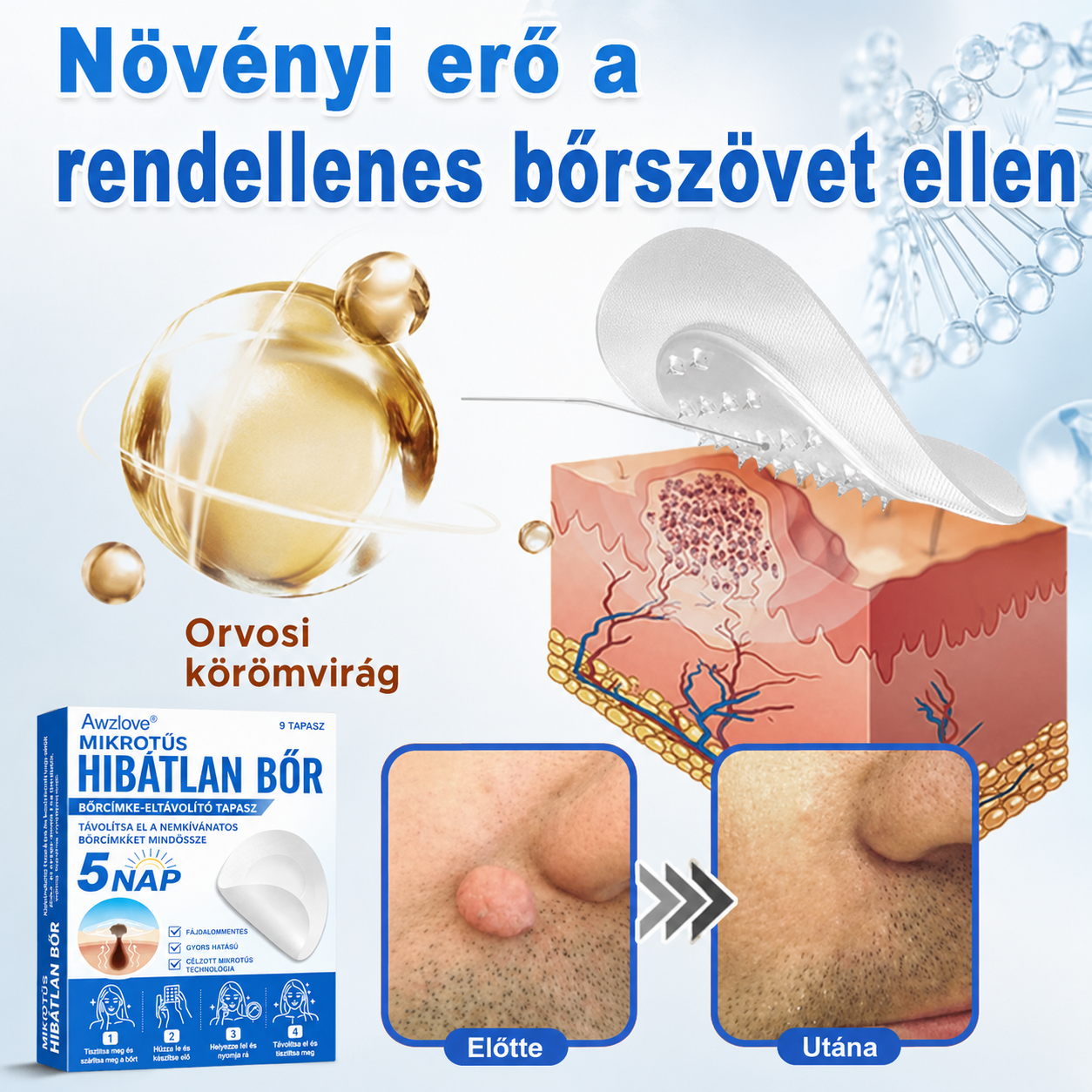 Awzlove® 2 az 1-ben mikrotűs és hidrokolloid tapasz | Kiemelkedő anyajegyek, pattanások, lapos szemölcsök és bőrkinövések eltávolítója | Javítja a ráncokat, hegeket és bőrhibákat | Láthatatlan csillag alakú pattanástapaszok arcra és testre | 🎁🎁8