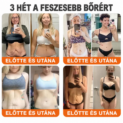 Rolimey® Méhmérges Bőrápoló Krém👩‍⚕️2🌲