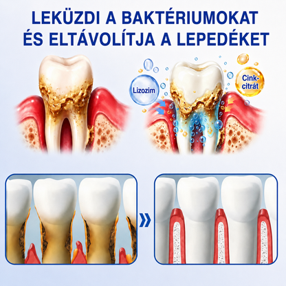 ☘️🇸🇰👨‍⚕️✅🦷𝐇𝐞𝐚𝐥𝐫𝐢𝐳𝐞® GumRevive fogágybetegség javító gél🦷🍋