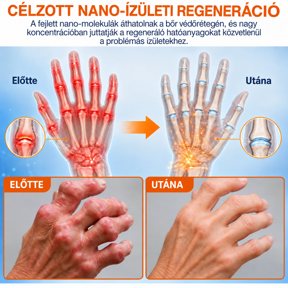 🌍✅ Hivatalos magyar áruház: Healrize® mikrotűs fájdalomcsillapító tapasz 🧑‍⚕️