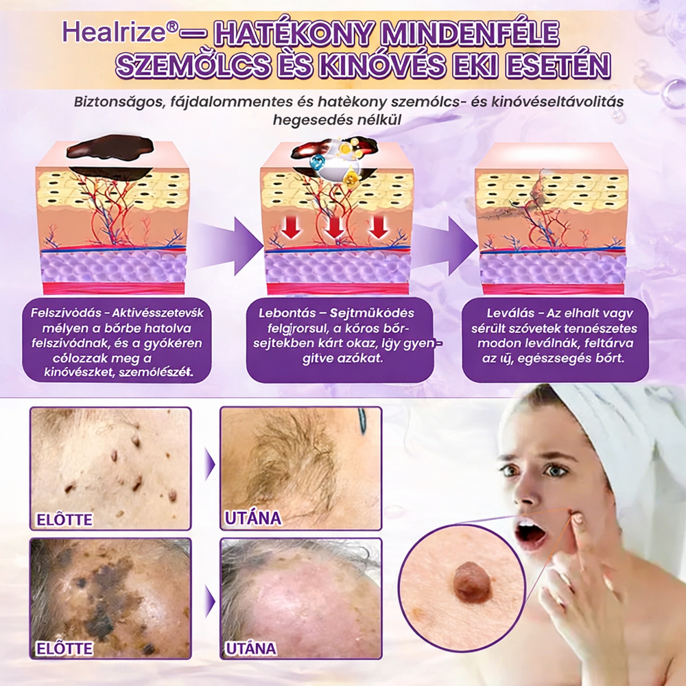 Magyarországon gyártva és szállítva ✨Healrize® Biotin 10 az 1-ben Bőrmegújító Krém 🥑