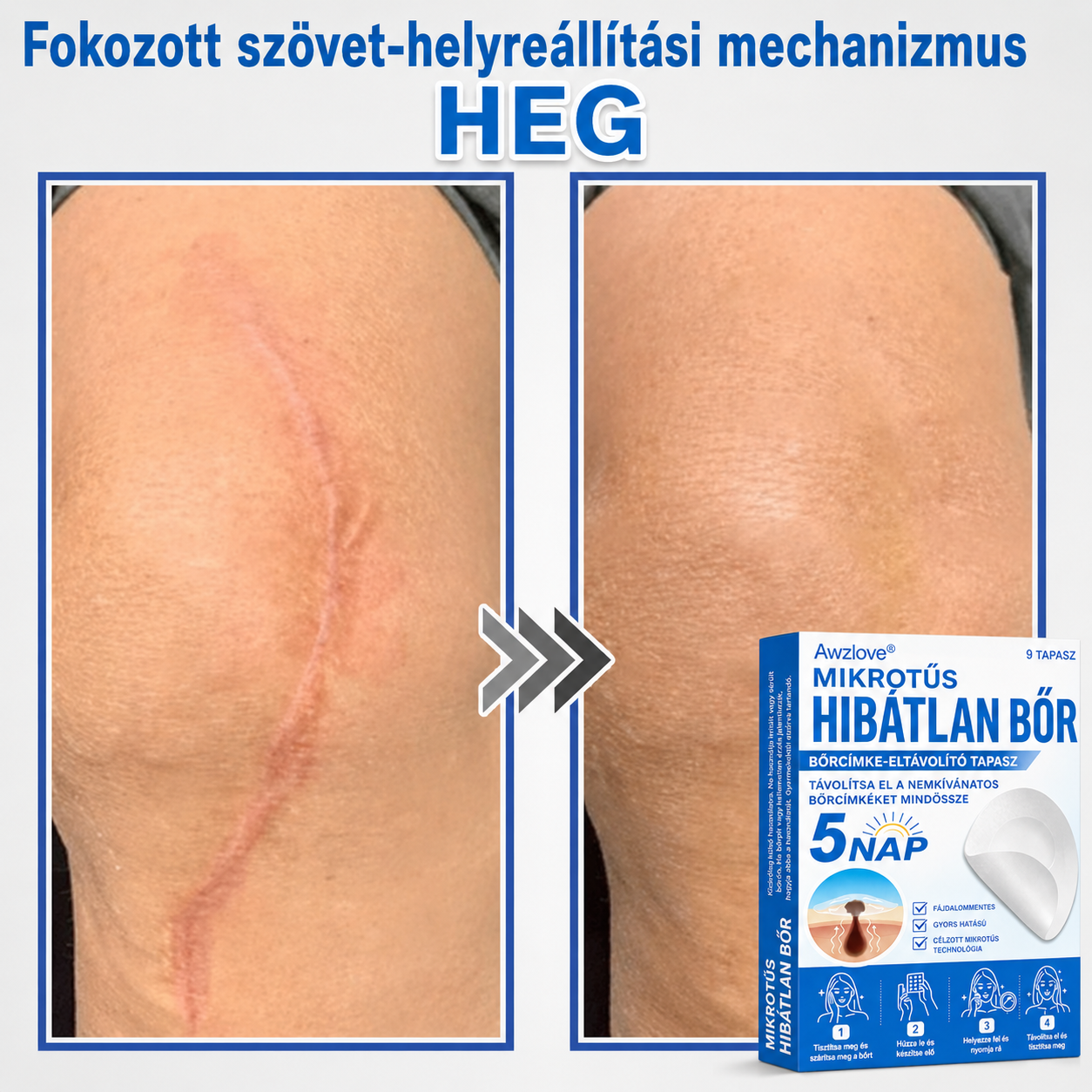 Awzlove® 2 az 1-ben mikrotűs és hidrokolloid tapasz | Kiemelkedő anyajegyek, pattanások, lapos szemölcsök és bőrkinövések eltávolítója | Javítja a ráncokat, hegeket és bőrhibákat | Láthatatlan csillag alakú pattanástapaszok arcra és testre | 🎁🎁8