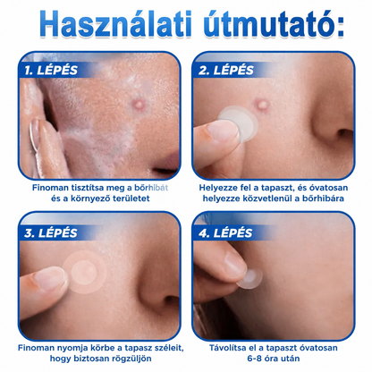 Awzlove® 2 az 1-ben mikrotűs és hidrokolloid tapasz | Kiemelkedő anyajegyek, pattanások, lapos szemölcsök és bőrkinövések eltávolítója | Javítja a ráncokat, hegeket és bőrhibákat | Láthatatlan csillag alakú pattanástapaszok arcra és testre | 🎁🎁8
