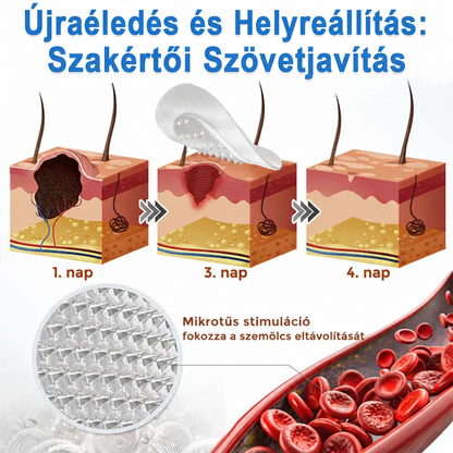 Awzlove® 2 az 1-ben mikrotűs és hidrokolloid tapasz | Kiemelkedő anyajegyek, pattanások, lapos szemölcsök és bőrkinövések eltávolítója | Javítja a ráncokat, hegeket és bőrhibákat | Láthatatlan csillag alakú pattanástapaszok arcra és testre | 🎁🎁8