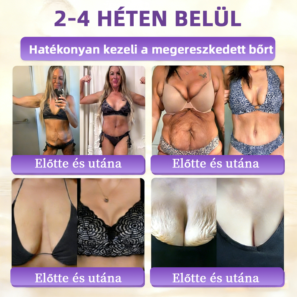 Magyarországon gyártva és szállítva ✨Healrize® Biotin 10 az 1-ben Bőrmegújító Krém 🥑