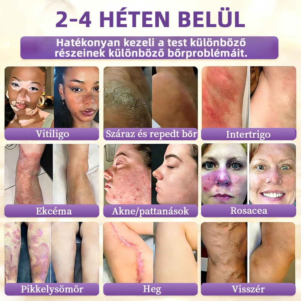 Magyarországon gyártva és szállítva ✨Healrize® Biotin 10 az 1-ben Bőrmegújító Krém 🥑