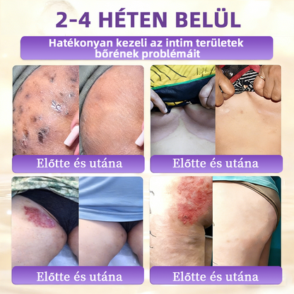 Magyarországon gyártva és szállítva ✨Healrize® Biotin 10 az 1-ben Bőrmegújító Krém 🥑