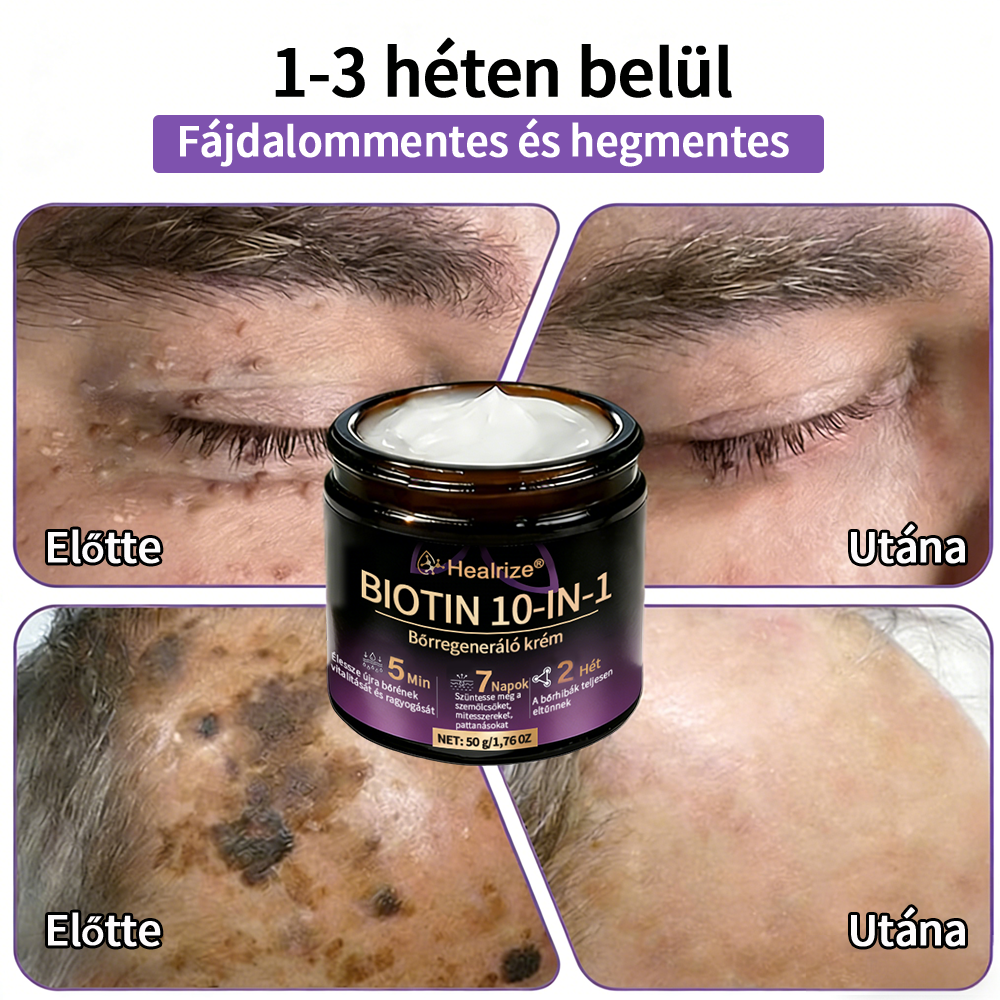 Magyarországon gyártva és szállítva ✨Healrize® Biotin 10 az 1-ben Bőrmegújító Krém 🥑