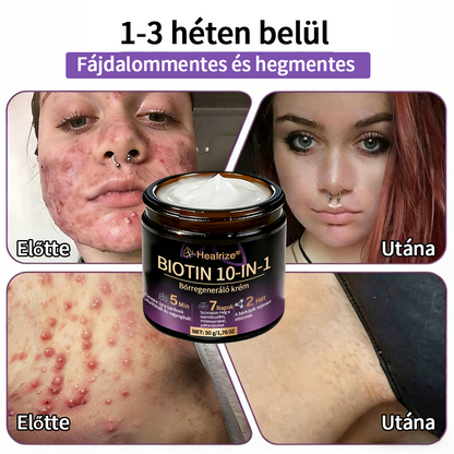 Magyarországon gyártva és szállítva ✨Healrize® Biotin 10 az 1-ben Bőrmegújító Krém 🥑