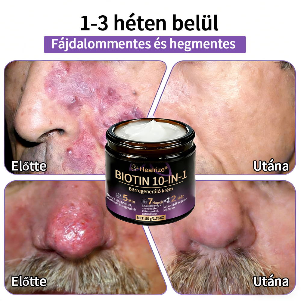 Magyarországon gyártva és szállítva ✨Healrize® Biotin 10 az 1-ben Bőrmegújító Krém 🥑