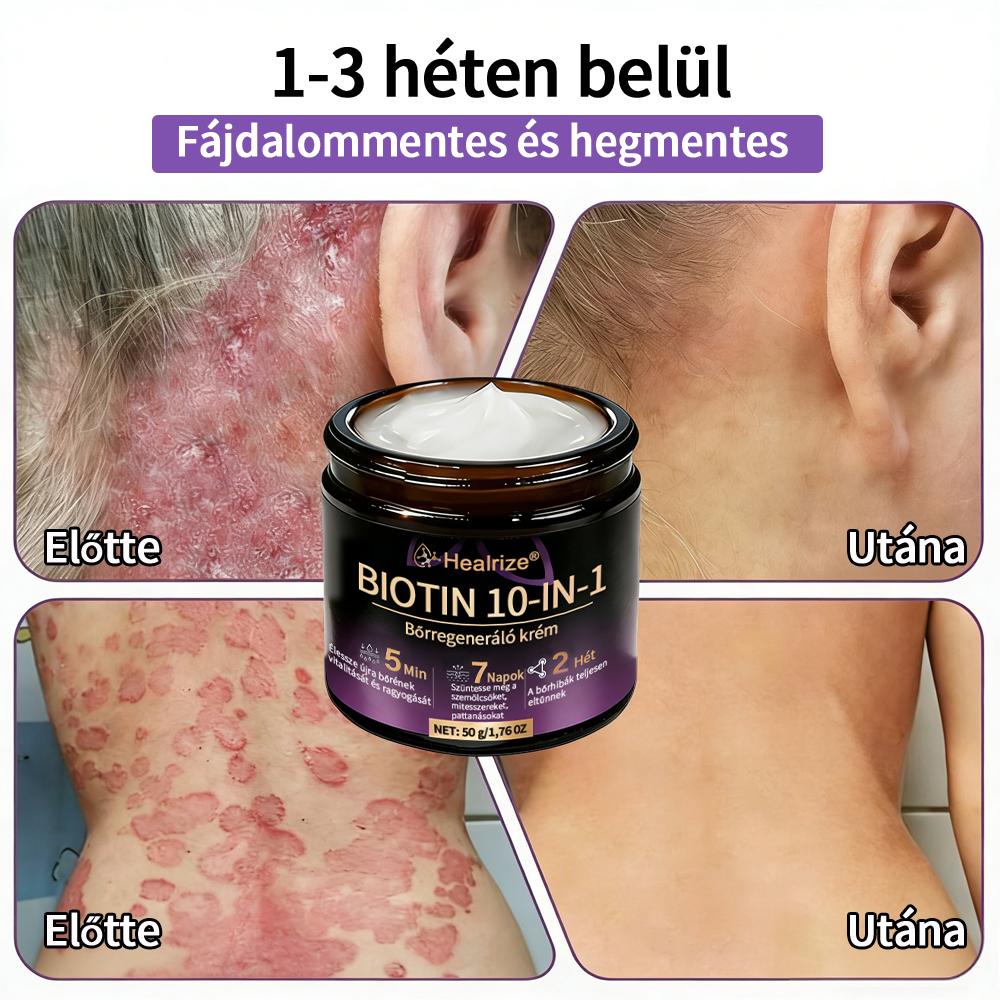 Magyarországon gyártva és szállítva ✨Healrize® Biotin 10 az 1-ben Bőrmegújító Krém 🥑