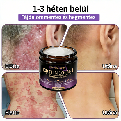 Magyarországon gyártva és szállítva ✨Healrize® Biotin 10 az 1-ben Bőrmegújító Krém 🥑
