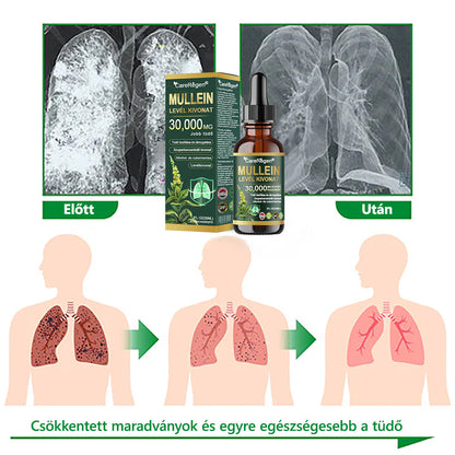 Hivatalos Bolt: CareRegen® Organikus Tüdőtisztító Ezüstlevelű Növény Kivonat Cseppek 💫 Klinikai vizsgálatokkal alátámasztott, magas koncentrációjú formula, amely enyhíti a köhögést, a nyákot, az asztmát és a COPD-t — könnyebb és gyorsabb légzés. 💫
