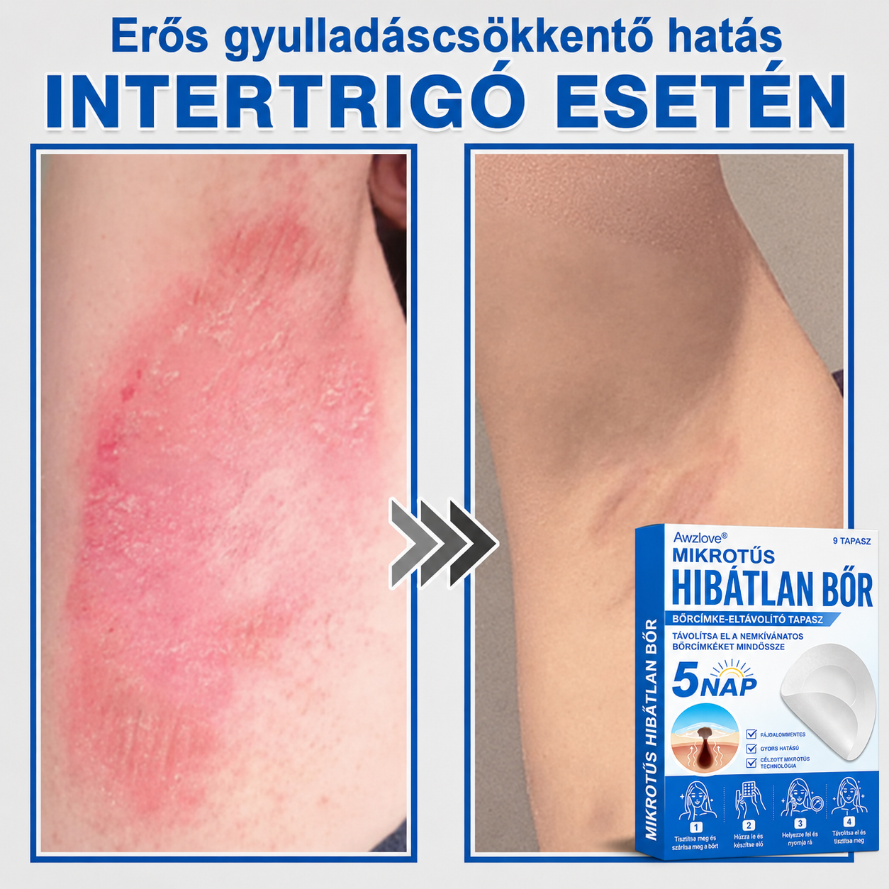 Awzlove® 2 az 1-ben mikrotűs és hidrokolloid tapasz | Kiemelkedő anyajegyek, pattanások, lapos szemölcsök és bőrkinövések eltávolítója | Javítja a ráncokat, hegeket és bőrhibákat | Láthatatlan csillag alakú pattanástapaszok arcra és testre | 🎁🎁8