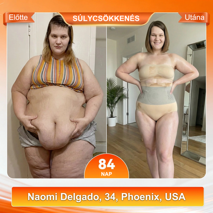 𝐇𝐢𝐯𝐚𝐭𝐚𝐥𝐨𝐬 𝐌𝐚𝐫𝐤𝐚𝐛𝐨𝐥𝐭 👙 EXPECTSKY® 𝟐𝟎𝟐𝟔 𝐌𝐨𝐫𝐢𝐧𝐠𝐚 & 𝐁𝐞𝐫𝐛𝐞𝐫𝐢𝐧 𝟒-𝐚𝐳-𝟏𝐛𝐞𝐧 𝐌𝐢𝐤𝐫𝐨𝐫𝐞𝐬𝐳𝐞𝐜𝐬𝐤𝐞-𝐀𝐥𝐤𝐨𝐭ó & 𝐙𝐬í𝐫é𝐠𝐞𝐭ő 𝐇𝐨𝐫𝐝𝐨𝐭𝐭 𝐒𝐡𝐨𝐫𝐭𝐬 🎀🎀2