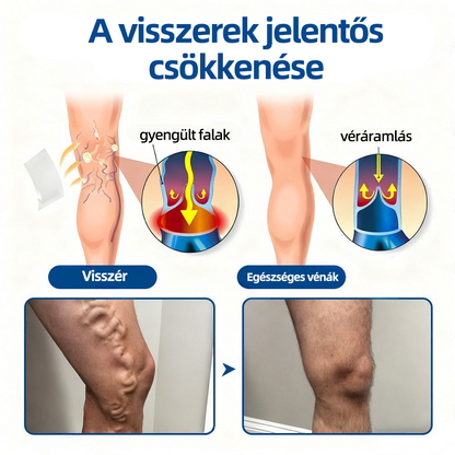 🇭🇺👨‍⚕️👍✅ Healrize® VeinTarget mikrotűs tapasz 💫Azonnali enyhülés, hosszú távú eredmények💫