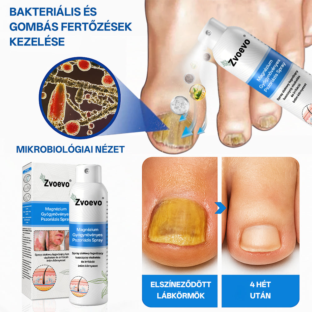 ⭐Healrize® 🎉Magnézium Gyógynövényes Pszoriázis Spray-🌻