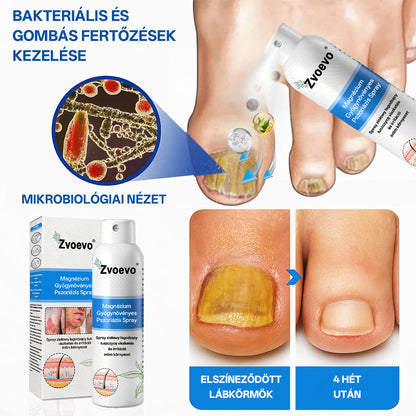 ⭐Healrize® 🎉Magnézium Gyógynövényes Pszoriázis Spray-🌻