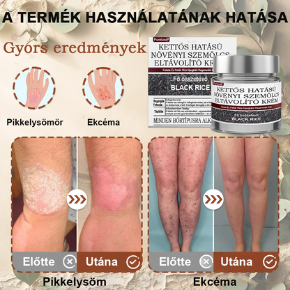 ✅ Healrize® Fekete Rizses Bőrregeneráló Krém 👨‍⚕️ (Szemölcsök, bőrkinövések, foltok és hiperpigmentáció kezelésére)✅✅✅✅