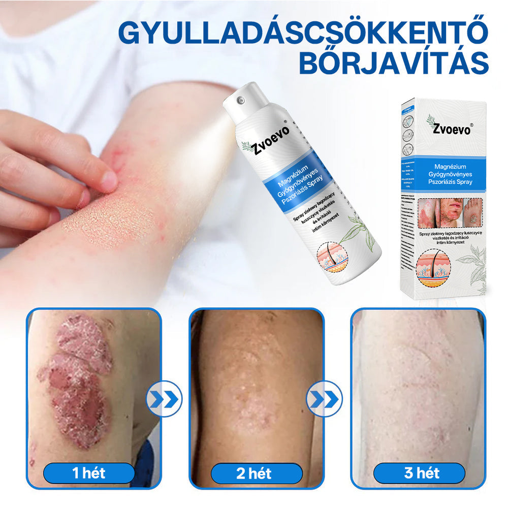 ⭐Healrize® 🎉Magnézium Gyógynövényes Pszoriázis Spray-🌻