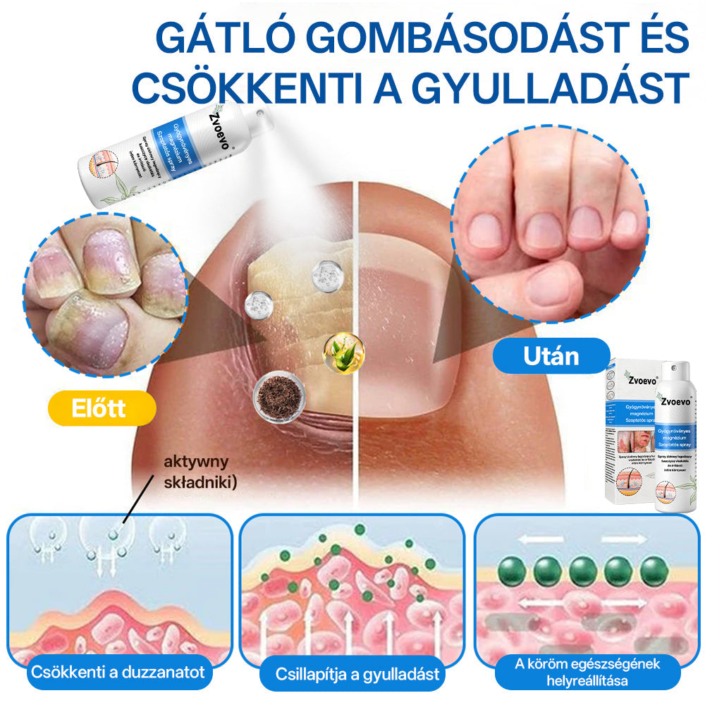 ⭐Healrize® 🎉Magnézium Gyógynövényes Pszoriázis Spray-🌻