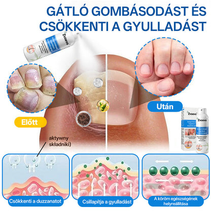 ⭐Healrize® 🎉Magnézium Gyógynövényes Pszoriázis Spray-🌻